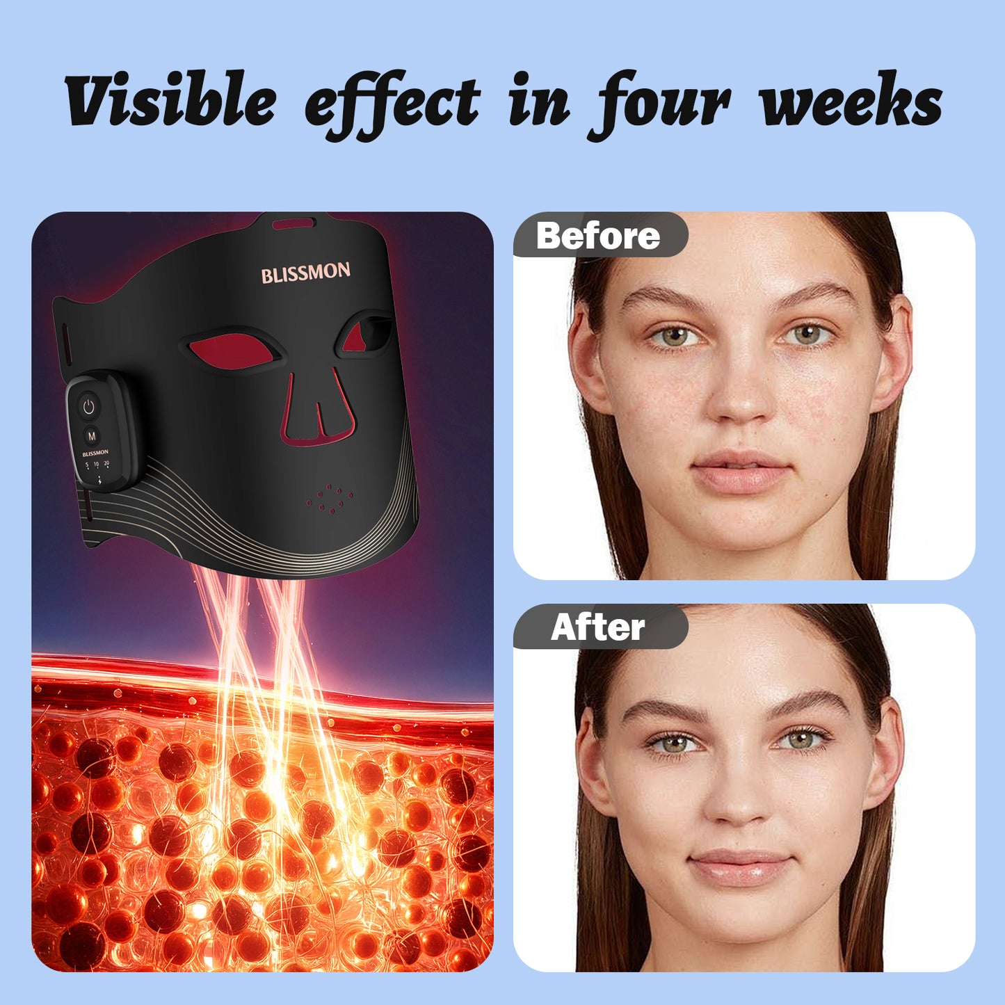 BLISSMON Red Light Therapy Mask for Face Anti-Aging Skin Firming Glow with 336 LEDs Face Mask 850NM Infrared |Wireless 2000mAh 4 Modes + Comfort Eye Protection